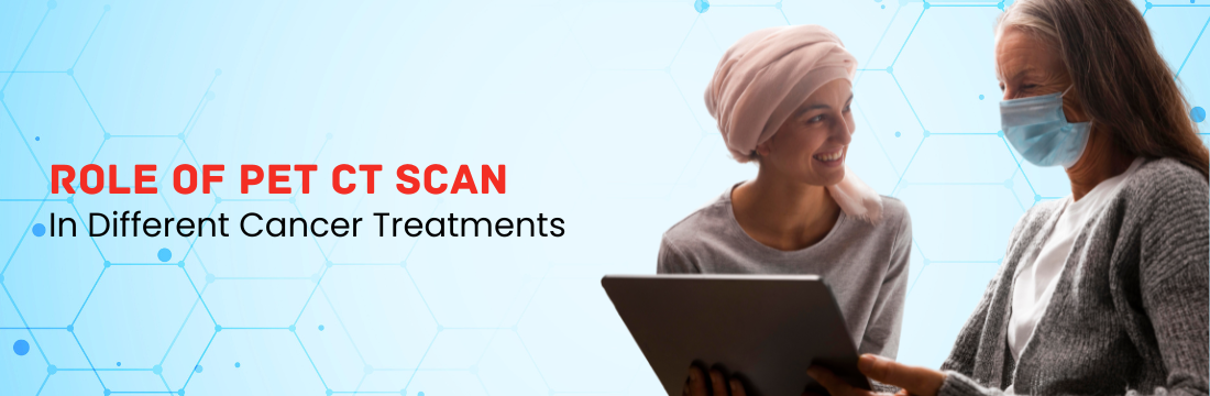 Role of PET CT in Different Cancer Treatments